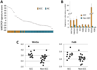 CAFET Algorithm Reveals Wnt/PCP Signature in Lung Squamous Cell Carcinoma