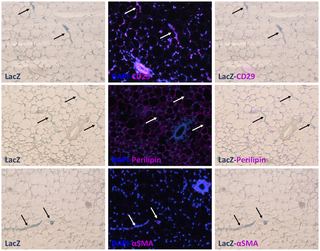Identification of Regulatory Elements That Control PPARγ Expression in Adipocyte Progenitors