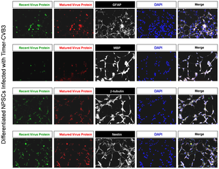 Coxsackievirus B Exits the Host Cell in Shed Microvesicles Displaying Autophagosomal Markers