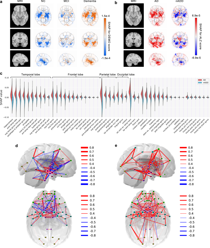 Multimodal, Explainable, and Adversarially-Robust Deep Learning for Alzheimer’s Disease Progression Detection